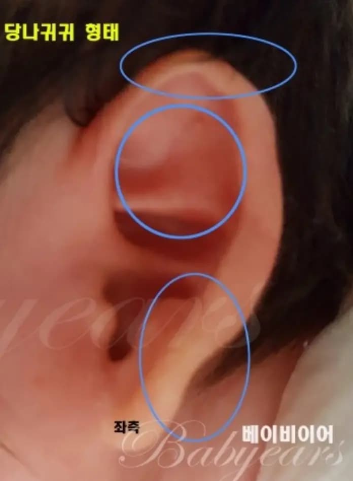 당나귀귀