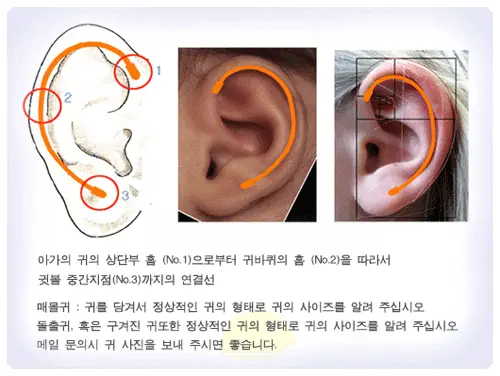측정방법